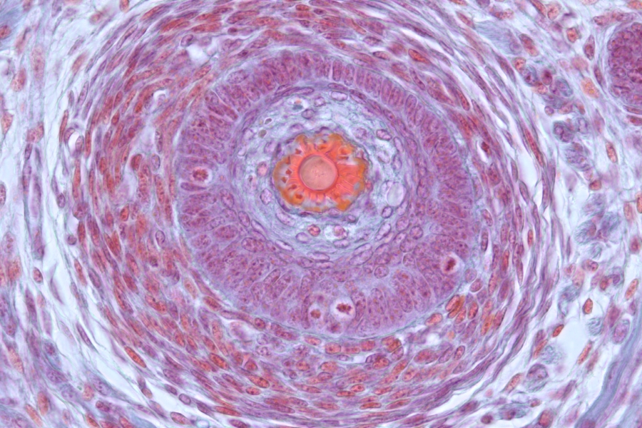 Folículo piloso de ratón — campo claro ZEISS Primostar 3
